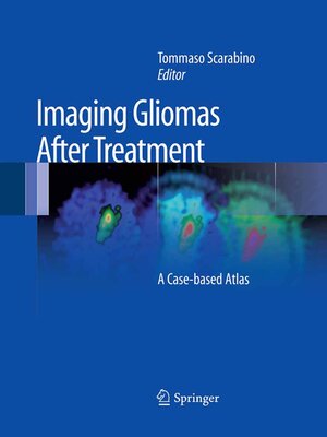 cover image of Imaging Gliomas After Treatment